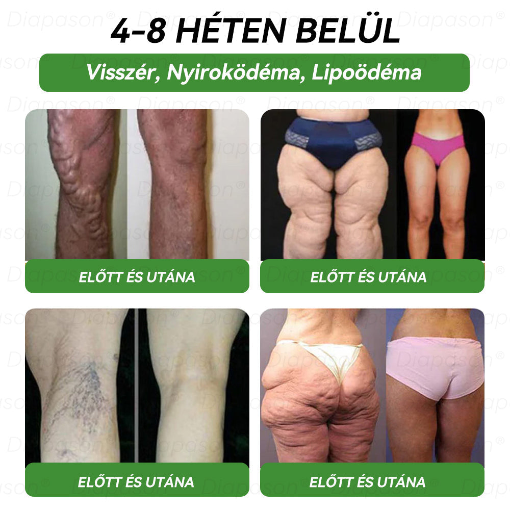đđČïœđčđȘđŒđšđ·Âźđ©ââïž GLP-1 HĂ©t az egyben egĂ©szsĂ©gĂŒgyi orĂĄlis oldat â naponta csak egyszer, több egĂ©szsĂ©gĂŒgyi problĂ©mĂĄra, mint az elhĂzĂĄs, a szĂv- Ă©s Ă©rrendszeri egĂ©szsĂ©g, a cukorbetegsĂ©g, az alvĂĄsi apnoe, a bĂ©lrendszer egĂ©szsĂ©ge Ă©s az ĂzĂŒleti problĂ©mĂĄk đŻ