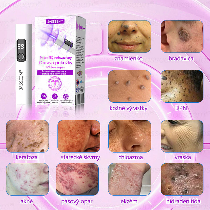 🟢𝐉𝐚𝐬𝐬𝐞𝐞𝐦® Pokročilé neinvazívne CO₂ laserové pero na opravu pokožky 💕 (Jemne odstraňuje bradavice, materské znamienka, starecké škvrny a kožné výrastky – bez bolesti, bez starostí!)