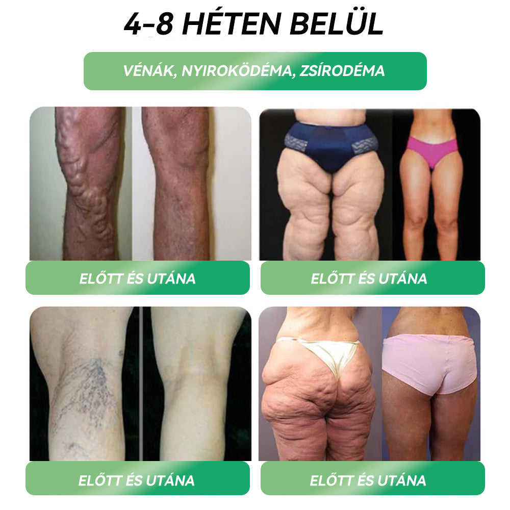 OGYÉI-kompatibilis 🇬🇧𝑆𝑇𝐷𝐸𝐼®𝐺𝐿𝑃-1 👩⚕️𝐹𝑜𝑔𝑦á𝑠 𝑆𝑧á𝑗𝑜𝑛 á𝑡 𝑎𝑙𝑘𝑎𝑙𝑚𝑎𝑧ℎ𝑎𝑡ó 𝑜𝑙𝑑𝑎𝑡Alkalmas elhízás, szív- és érrendszeri betegségek, cukorbetegség, alvási apnoe, ízületi problémák és egyebek esetén ⭐