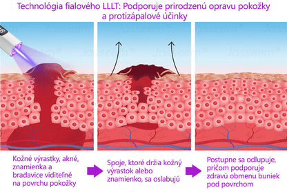 🟢𝐉𝐚𝐬𝐬𝐞𝐞𝐦® Pokročilé neinvazívne CO₂ laserové pero na opravu pokožky 💕 (Jemne odstraňuje bradavice, materské znamienka, starecké škvrny a kožné výrastky – bez bolesti, bez starostí!)