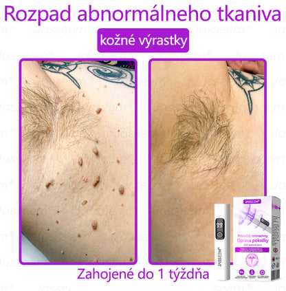 🟢𝐉𝐚𝐬𝐬𝐞𝐞𝐦® Pokročilé neinvazívne CO₂ laserové pero na opravu pokožky 💕 (Jemne odstraňuje bradavice, materské znamienka, starecké škvrny a kožné výrastky – bez bolesti, bez starostí!)